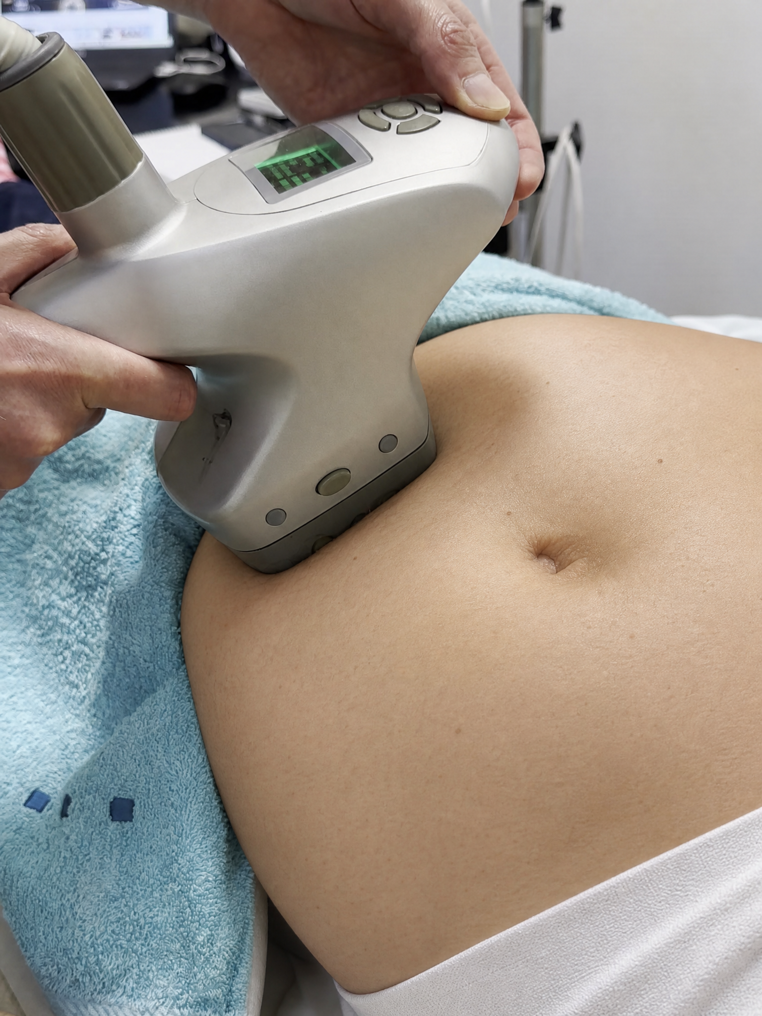 Radiofrekvens bodyshaping behandling mage